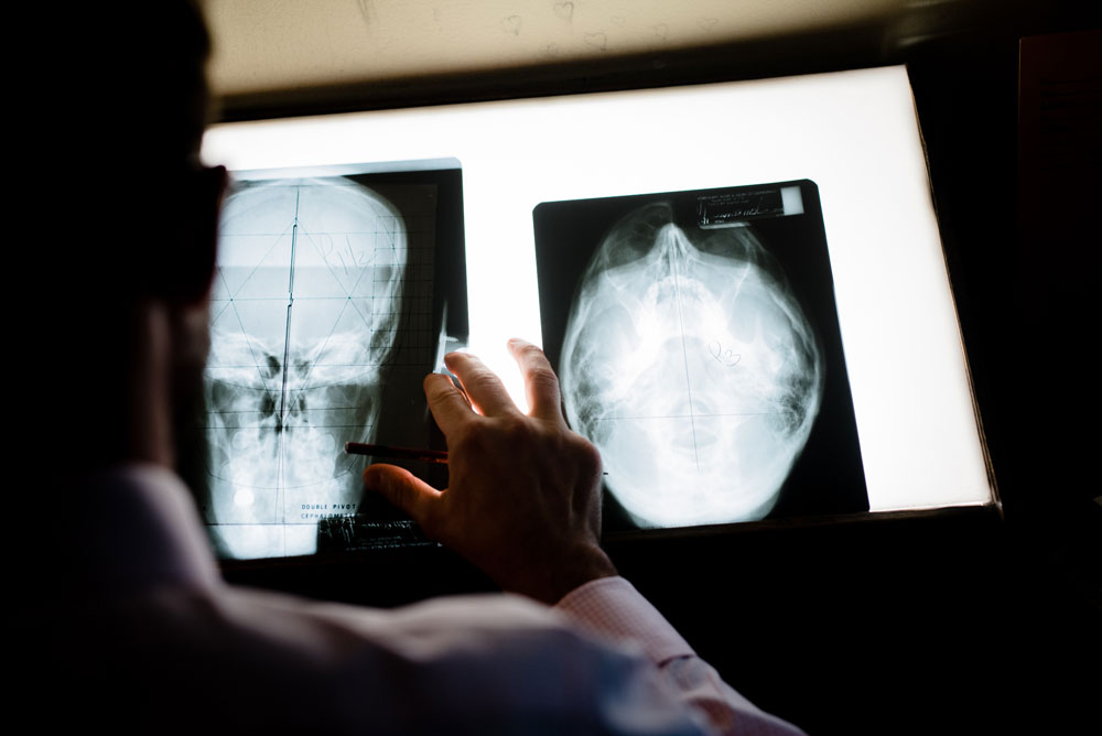 The Problem | The Goodman Method of Chiropractic